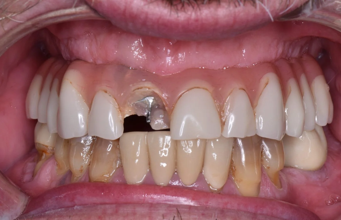 Before Image