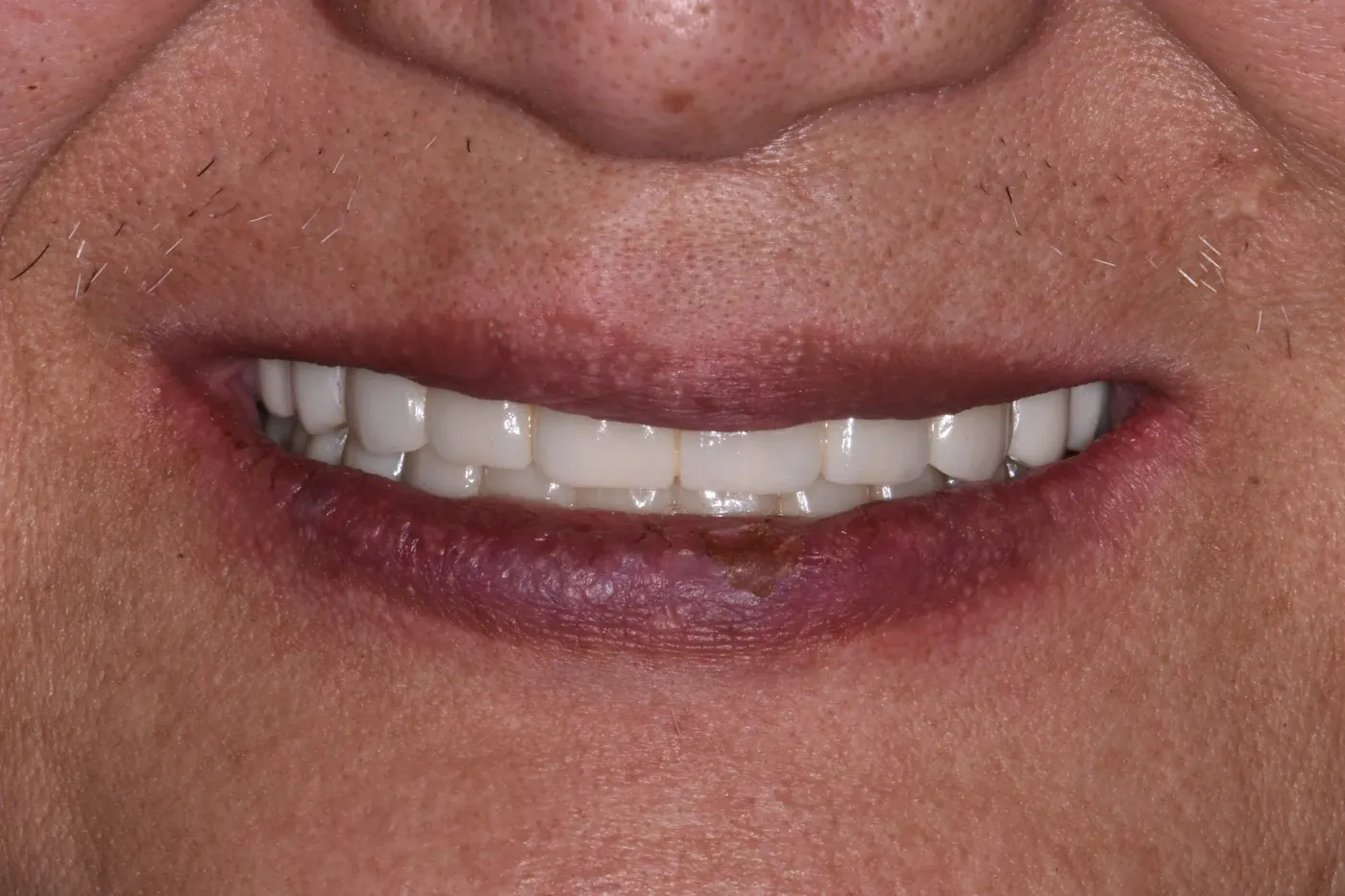 After Image