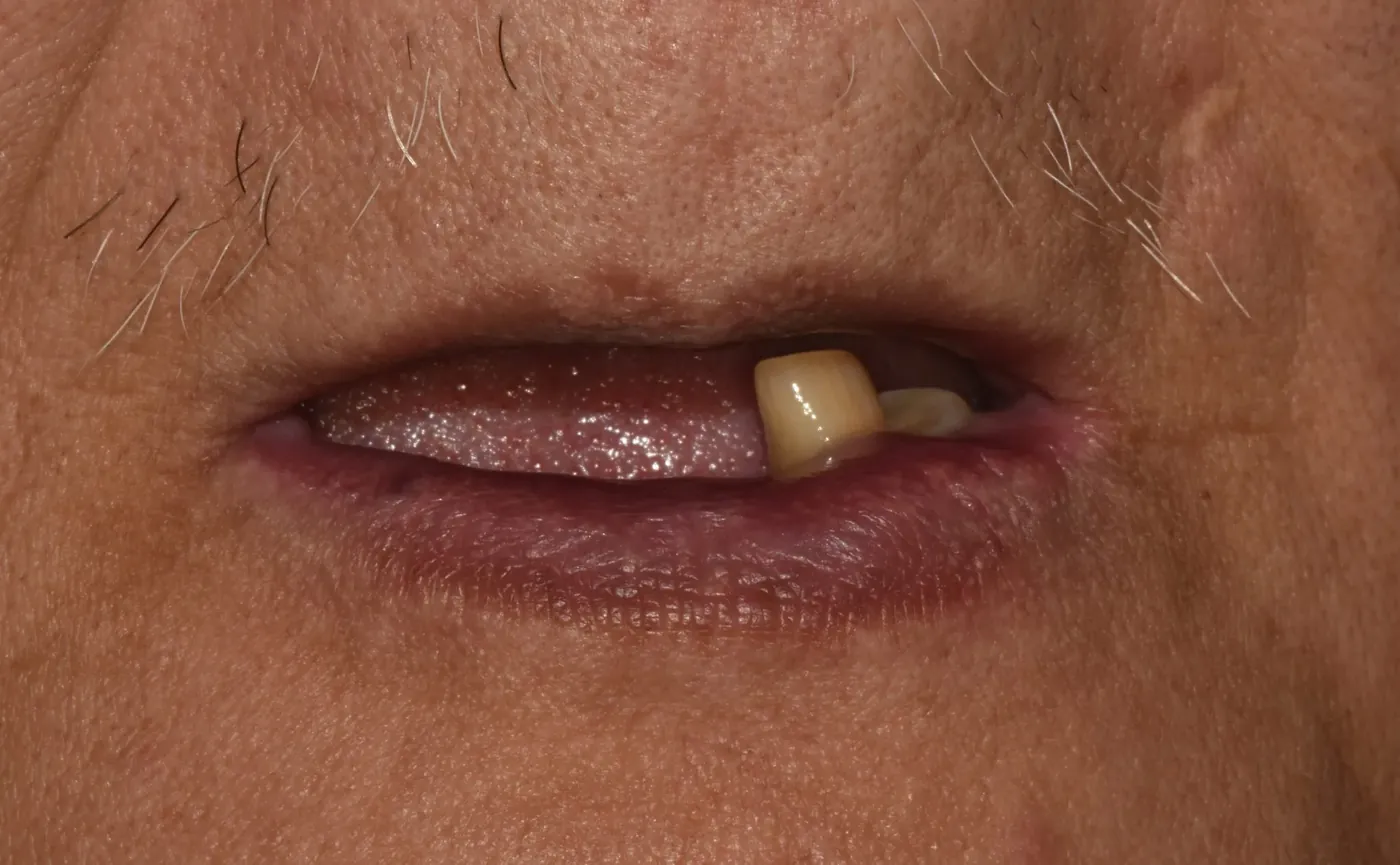 Before Image
